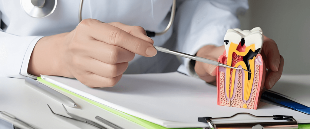 Root canal treatment at Vega Medical Center Dubai – preserving natural teeth and relieving pain.
