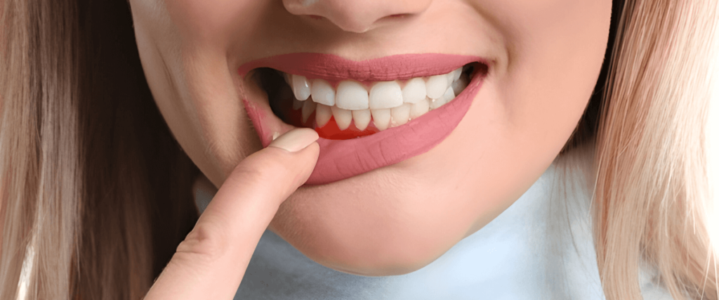 Gum treatment procedure at Vega Medical Center Dubai.