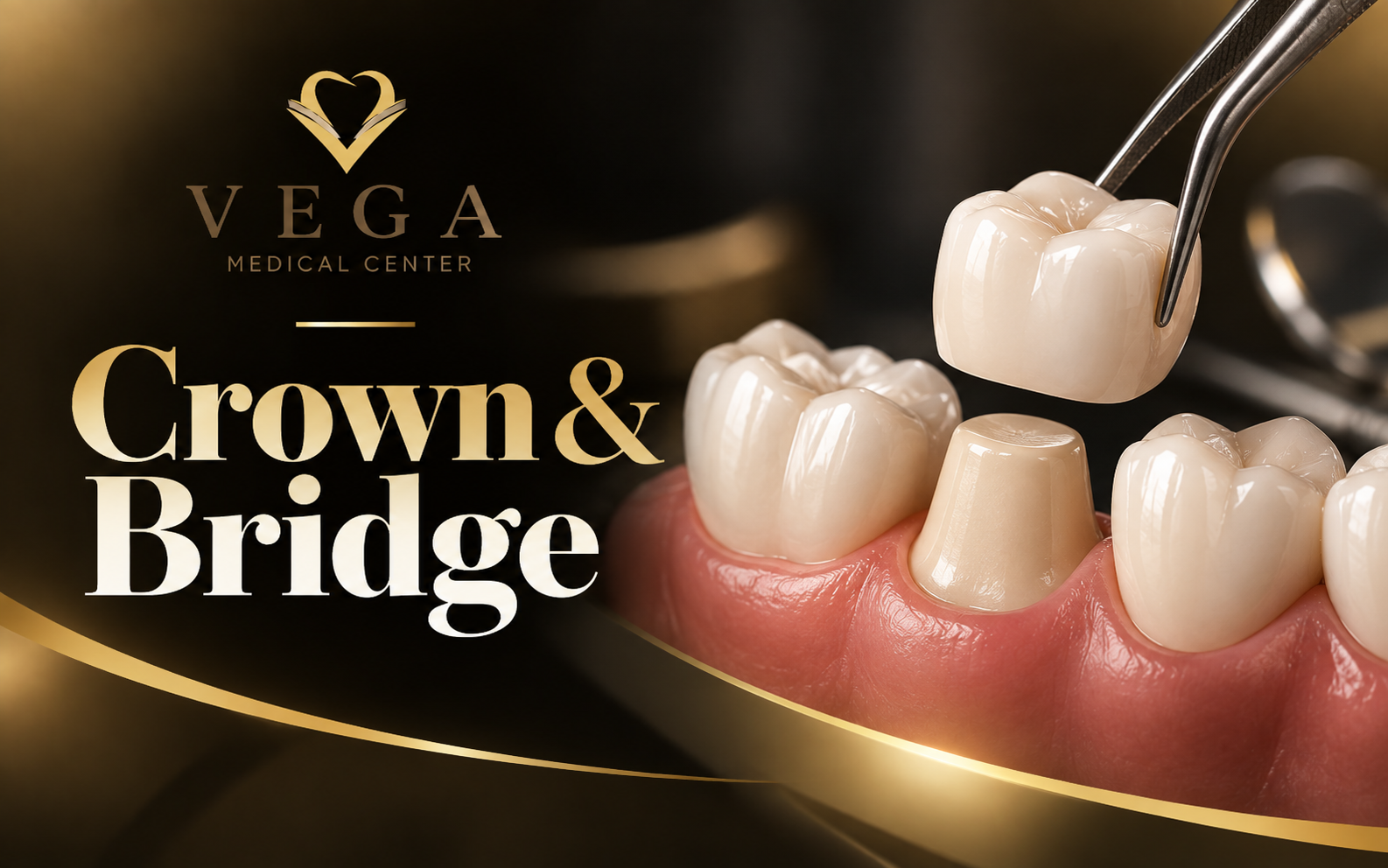 Dental crowns and bridges at VEGA Medical Center, Al Rigga, Deira