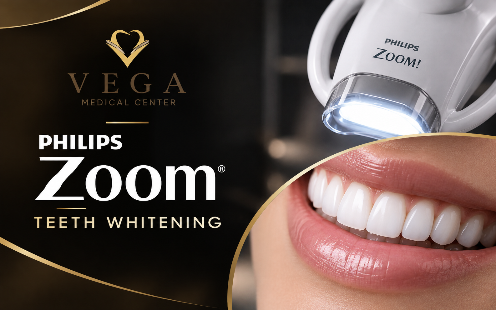 Philips Zoom teeth whitening at VEGA Medical Center, Al Rigga, Deira