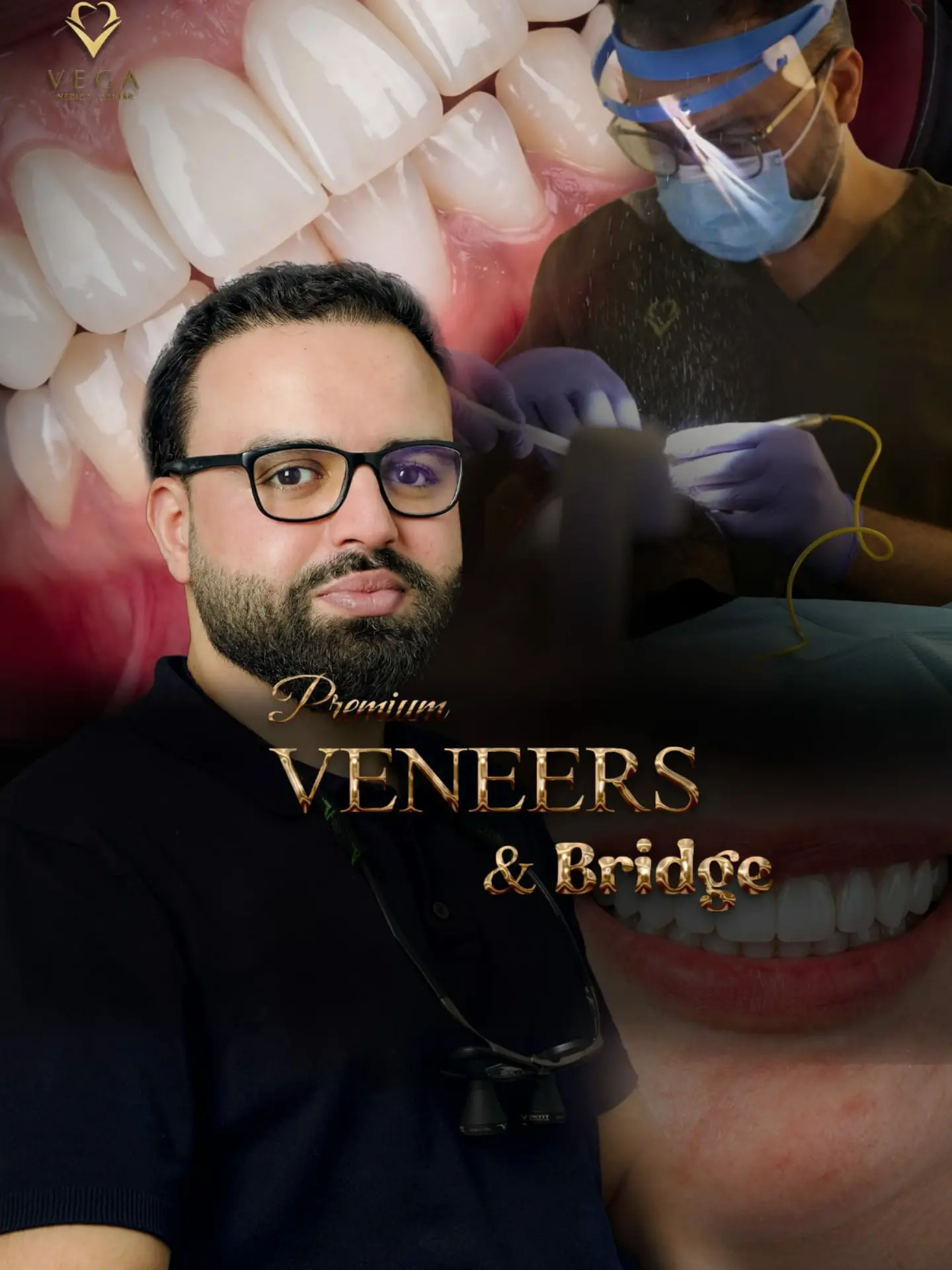 Smile transformation with veneers and bridges at Vega Medical Center