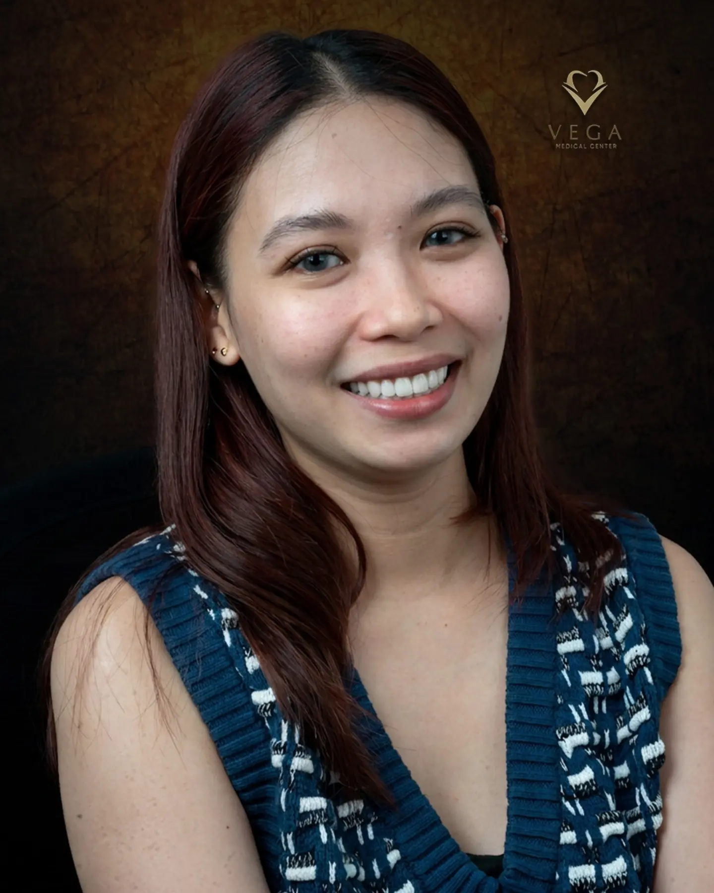Dental crowns and bridges smile restoration