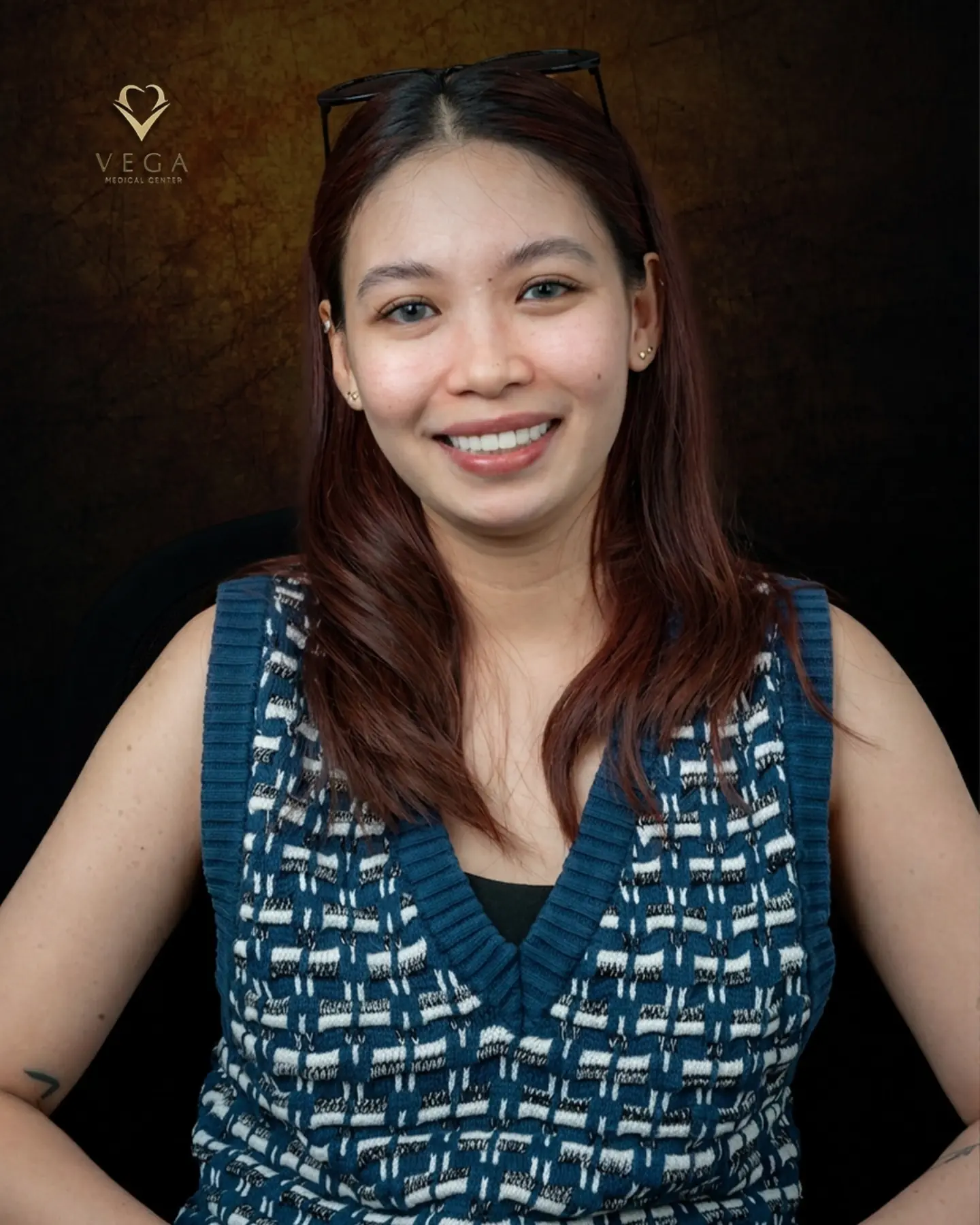 Dental crowns and bridges smile restoration