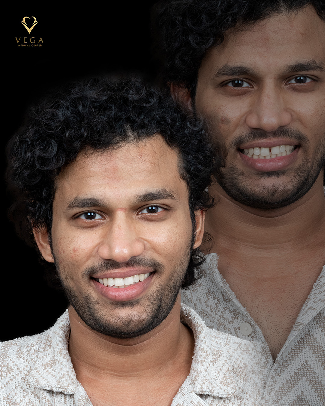 Patient smile after treatment with before image alongside