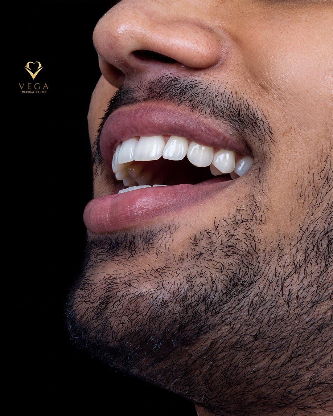 After treatment - close-up of restored front teeth